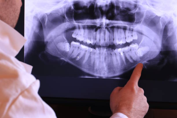 Best Emergency Treatment for Toothache in Danbury, TX